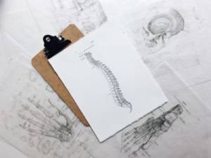 penyakit spondilosis, rumah sakit awal bros makassar, dokter spesialis tulang, dokter spesialis orthopaedi dan trauma