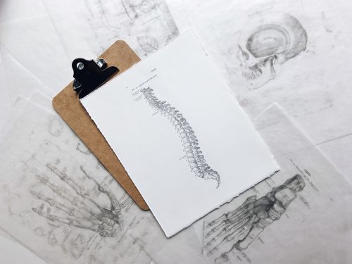 penyakit spondilosis, rumah sakit awal bros makassar, dokter spesialis tulang, dokter spesialis orthopaedi dan trauma