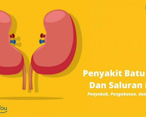 Penyakit Batu Ginjal Dan Saluran Kemih _ Penyebab, Pengobatan, dan Pencegahan, Tindakan ESWL
