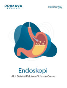 Endoskopi