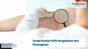 Terapi Kanker Kulit Pengobatan dan Penanganan