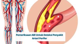 Pemeriksaan ABI Untuk Deteksi Penyakit Arteri Perifer