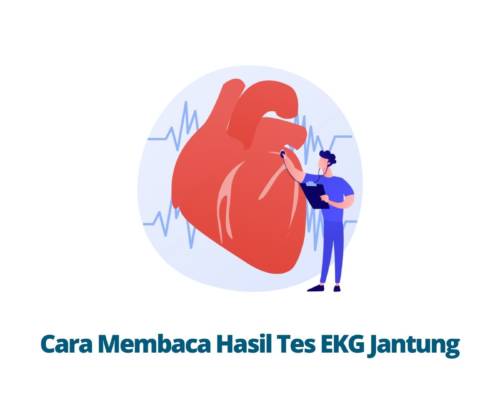 Cara Membaca Hasil Tes EKG Jantung