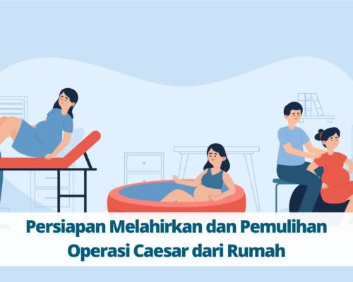 Persiapan Melahirkan dan Pemulihan Operasi Caesar dari Rumah