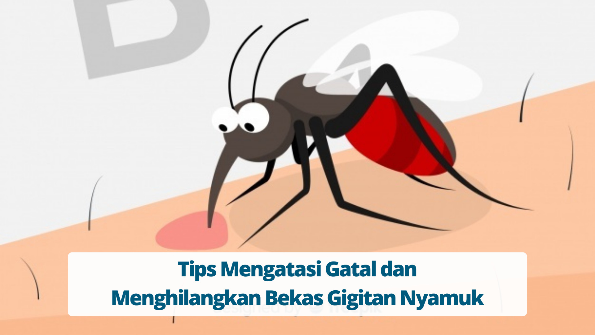 Tips Mengatasi Gatal dan Menghilangkan Bekas Gigitan Nyamuk