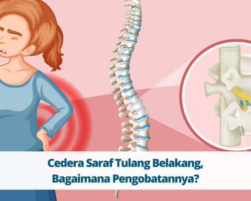 Cedera Saraf Tulang Belakang, Bagaimana Pengobatannya