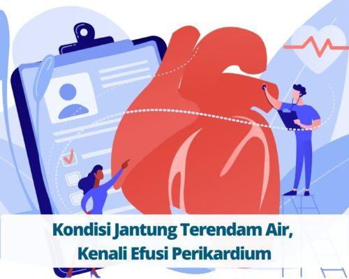 Kondisi Jantung Terendam Air, Kenali Efusi Perikardium