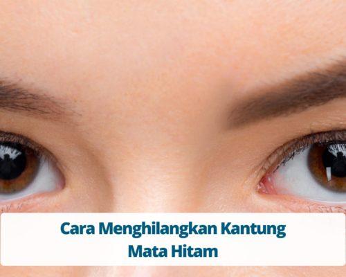 Cara Menghilangkan Kantung Mata Hitam