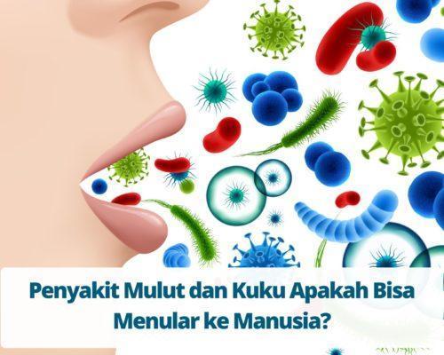 Penyakit Mulut dan Kuku Apakah Bisa Menular ke Manusia