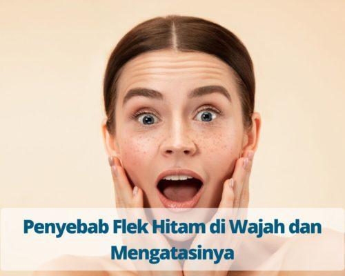 Penyebab Flek Hitam di Wajah dan Mengatasinya