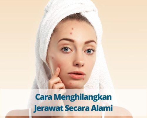 Cara Menghilangkan Jerawat Secara Alami