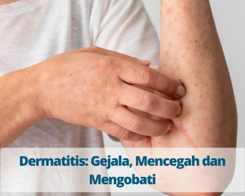 Dermatitis Gejala, Mencegah dan Mengobati