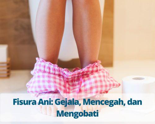 Fisura Ani Gejala, Mencegah, dan Mengobati