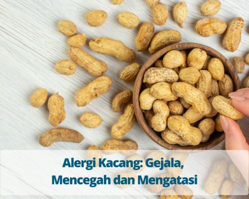 Alergi Kacang Gejala, Mencegah dan Mengatasi