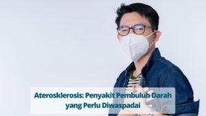 Aterosklerosis: Penyebab Penyempitan Pembuluh Darah