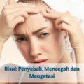 Bisul Penyebab, Mencegah dan Mengatasi