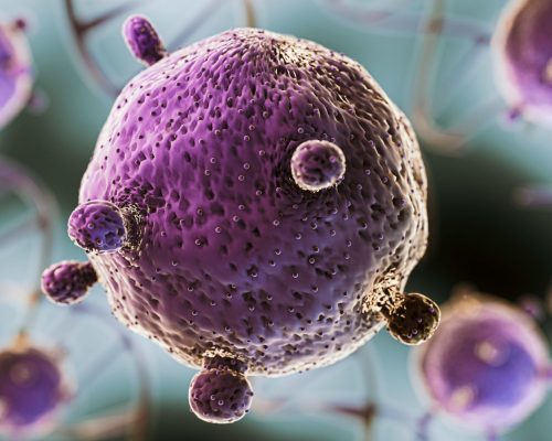 Cholangiocarcinoma Kanker Langka pada Saluran Empedu