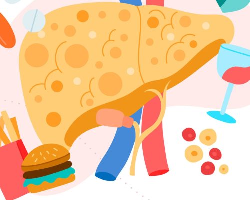 Cholangitis Infeksi pada Saluran Empedu yang Perlu Diketahui