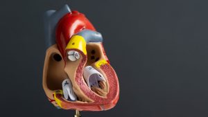 Percutaneus Transvenous Mitral Commissurotomy (PTMC)Balloon Mitral Valvulotomy