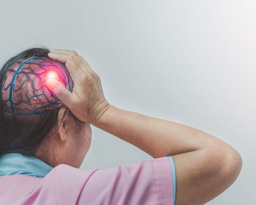 Kenali Astrositoma, Jenis Tumor yang Dapat Mengancam Nyawa