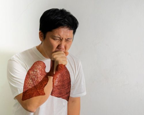 Mengenal Apa itu Pneumonia dan Penyebabnya yang Wajib Diwaspadai