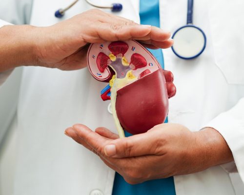 Mengenal Nephrolithotomy Tindakan Bedah Atasi Batu Ginjal