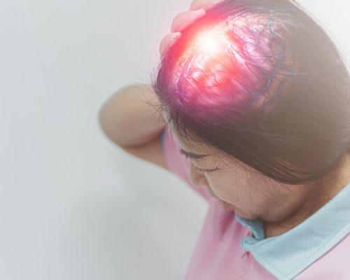 Mengenal Neuro-onkologi