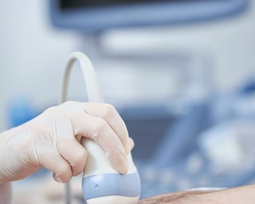 Intravascular Ultrasound