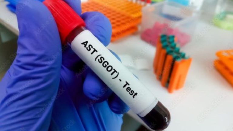 Pemeriksaan AST/SGOT untuk Mengetahui Kondisi Fungsi Hati - Primaya ...