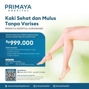 Kaki Sehat dan Mulus Tanpa Varises – Primaya Hospital Karawang