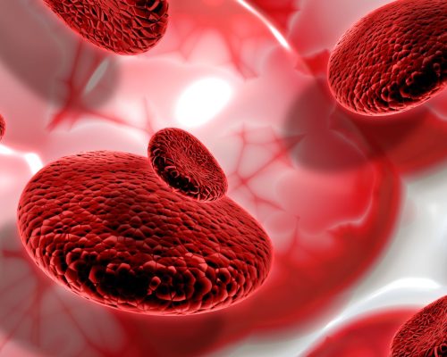 Leukemia