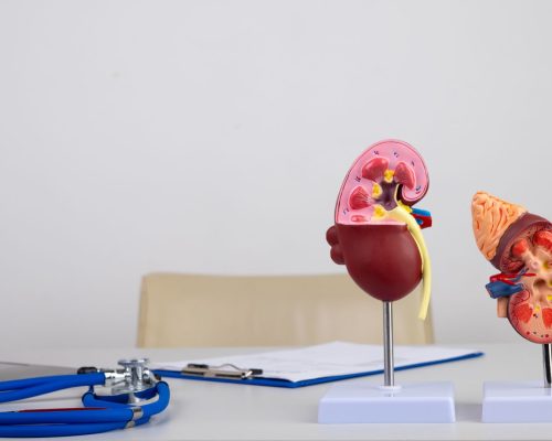 Transplantasi ginjal