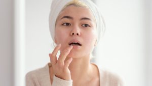 bibir kering