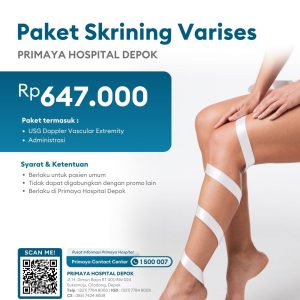 Skrining varises Depok