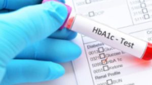 Pemeriksaan HBa1C
