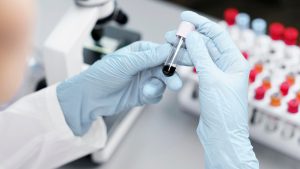 Preimplantation Genetic Testing