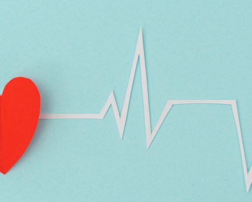 Atrial Flutter