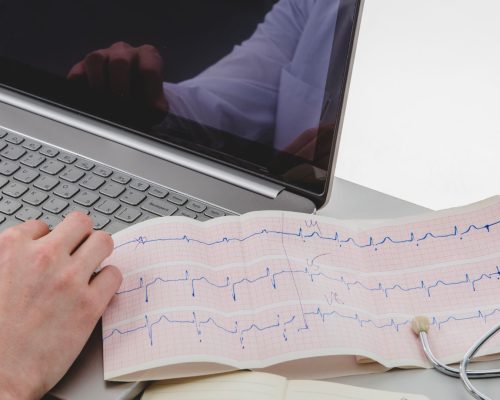 Insufisiensi Mitral