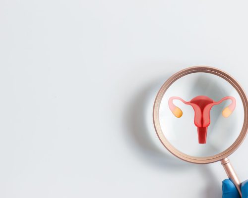kanker vulva
