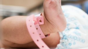 Memahami Penyebab Kelainan Kongenital pada Bayi dan Pencegahannya