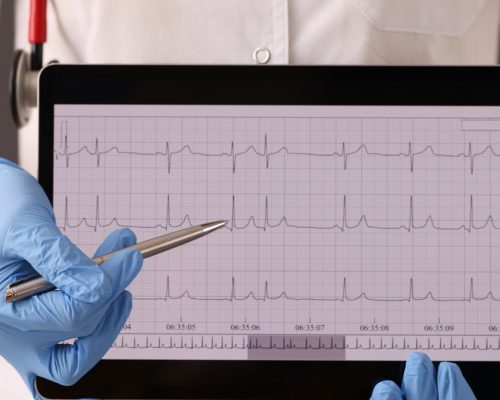 elektrokardiografi