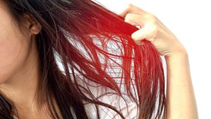 Rambut tipis
