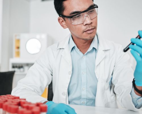 hiperlipidemia