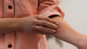 Dermatomiositis