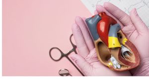 angioplasty
