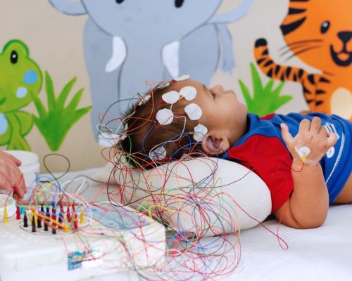 EEG pada anak