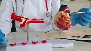 Intravascular lithotripsy