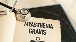 Myasthenia Gravis