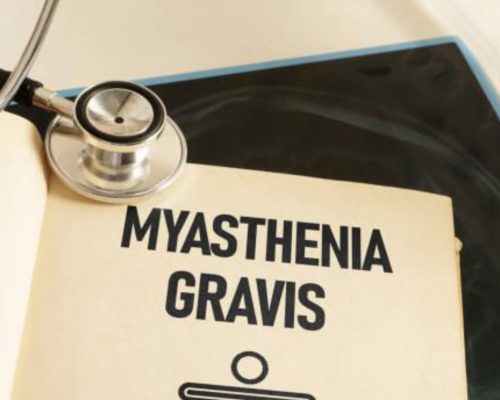 Myasthenia Gravis