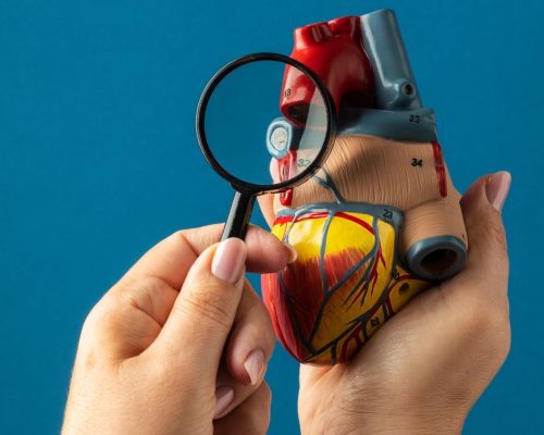 Zero fluoroscopy ablation